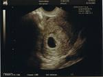 Gummy_Bear_7_26_05_5_weeks_4_days.jpg
